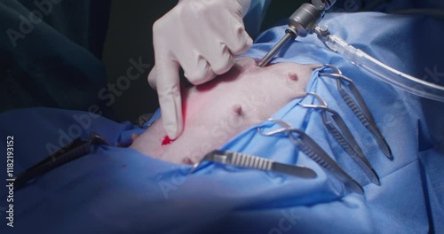 Endoscopic sterilization of a dog by a team of veterinary surgeons. In the light of a surgical lamp, a veterinarian sterilizes a dog using an endoscopic method. Veterinary endoscopy.