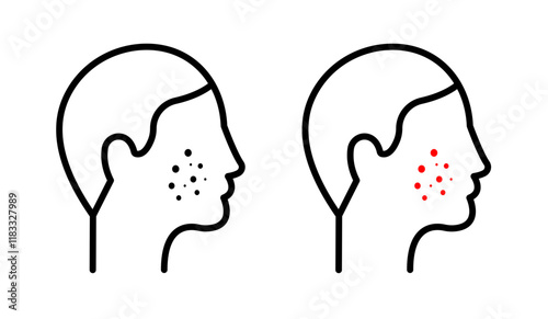 Man acne on face icons set in black filled and line stroke style on white background