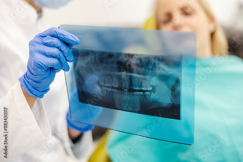 Close up of dentist's hand holding panoramic x-ray and showing it to a woman at dentist office. photo