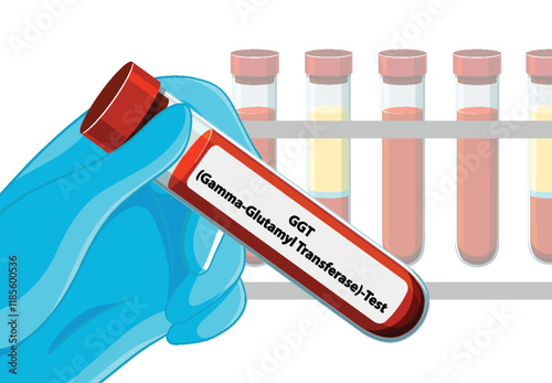 Medical Blood Test Illustration photo