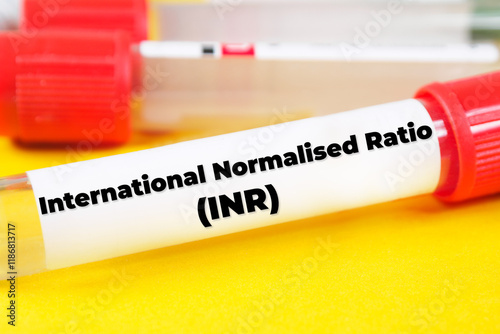 International Normalised Ratio (INR) text meaning analysis photo