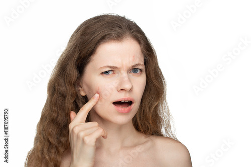 A beautiful young woman with real acne and pimples examines her skin closely. She appears surprised, upset, and frustrated by the breakouts. White background. Studio portrait photo