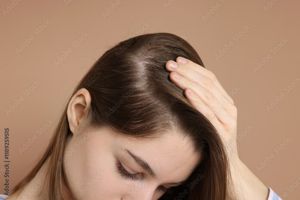 Fototapeta premium Girl with hair loss problem on dark beige background, closeup