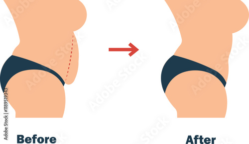 weight loss before and after 