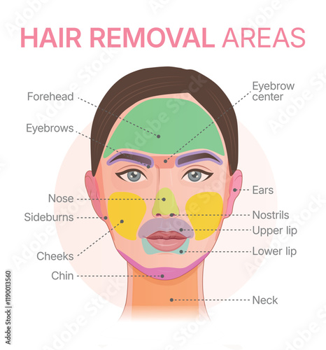 Face epilationVector diagram showing facial hair removal areas. Illustration showing laser epilation zones.