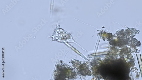 vorticella under the microscope - genus of bell-shaped ciliates (protozoa) - optical microscope x400 magnification photo