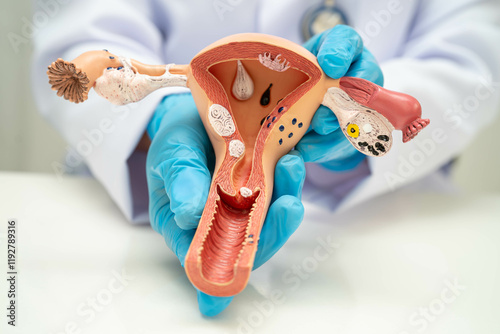 Uterus, doctor holding human anatomy model for study diagnosis and treatment in hospital. photo