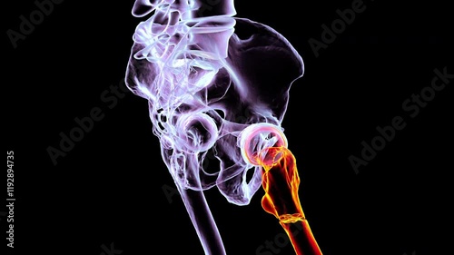 3D animation of pelvic bones with a subtrochanteric fracture of the right femur, rotating 360 degrees in colorful X-ray style, with the right femur in orange and other bones in purple. photo