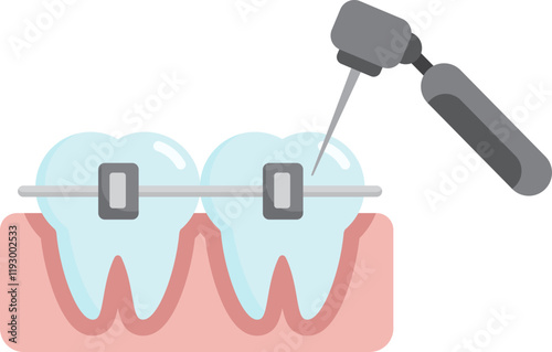 braces cleaning tooth teeth drill tool