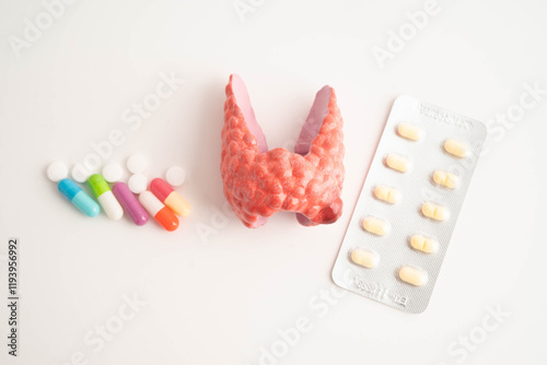 Thyroid model with pill drug treatment, Hyperthyroidism, Overactive or Lymphoma. photo