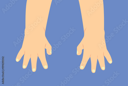 Cute Adorable Baby Hands Isolated on Blue Background. Newborn hands with short nail vector illustration
