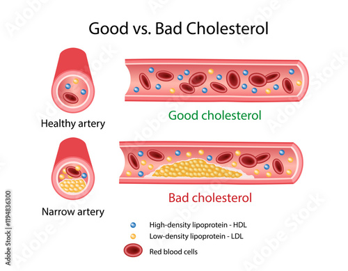 Good vs. Bad Cholesterol. Blood artery in longitudinal and cross-section: healthy and with cholesterol plaques. Vector illustration in flat style isolated on white background