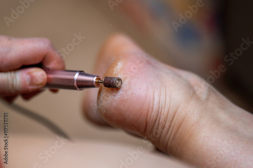 foot care session, showcasing an automatic device with an abrasive attachment gently exfoliating hardened skin from the heels for smooth, healthy feet photo