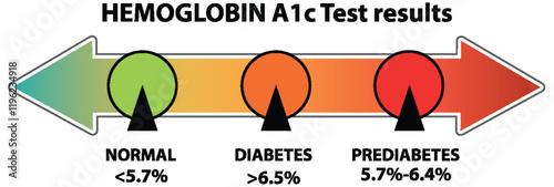 Hemoglobin A1c Test Results Guide