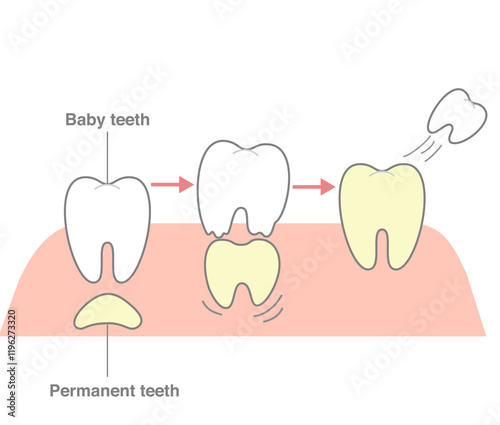 The process where permanent teeth push through and replace baby teeth by dissolving them.