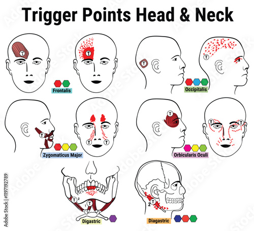 Head and Neck trigger points vector Diagram