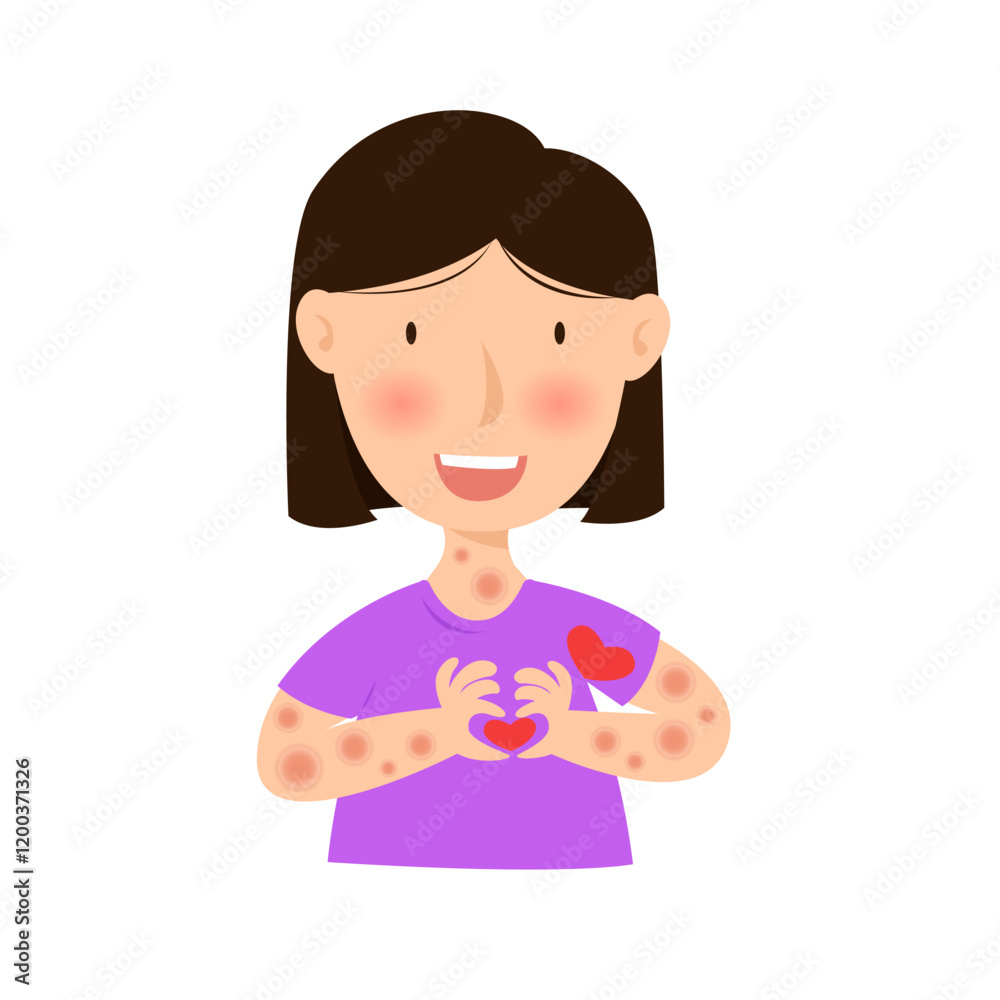 leprosy disease. mycobacterium leprae infection concept leprosy disease. mycobacterium leprae infection concept