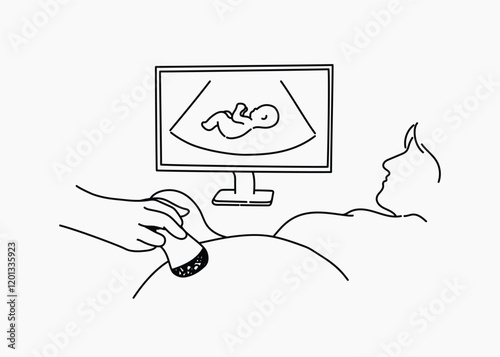 Pregnancy ultrasound scan hand drawn illustration vector