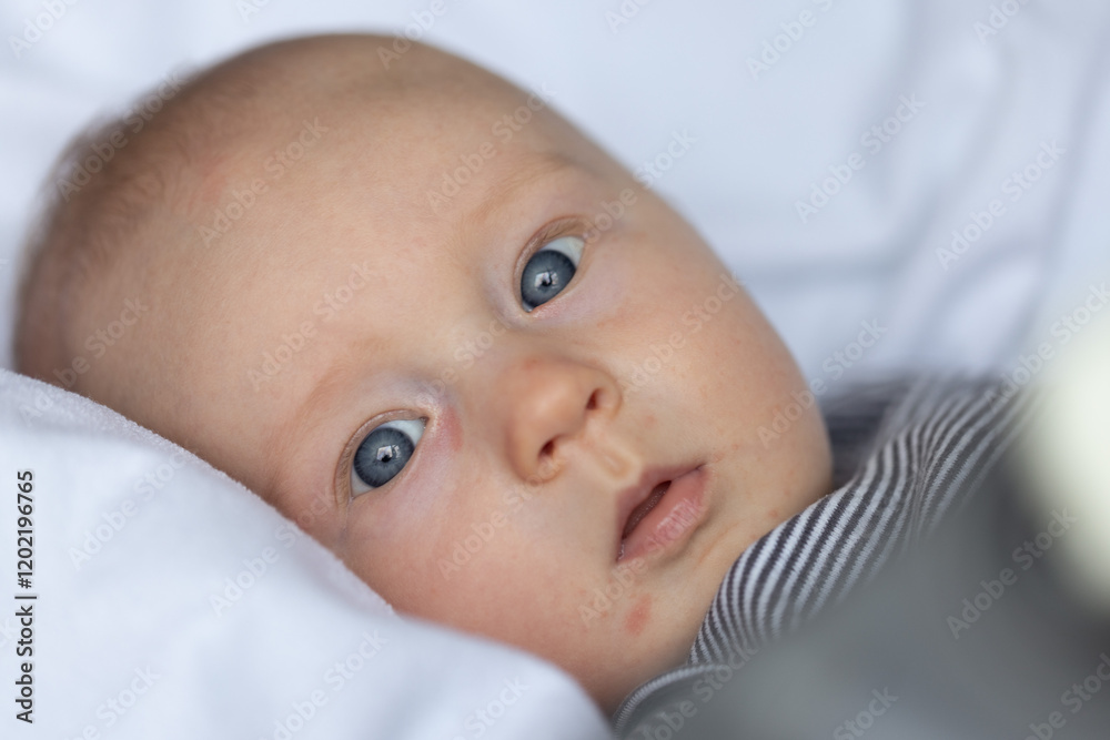 Newborn baby with red pimples on the face and red spots under eyes. Closeup. Newborn baby with red pimples on the face and red spots under eyes. Closeup.