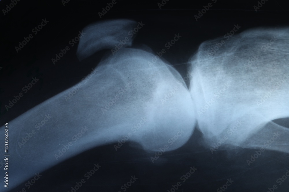Obraz premium X-ray image of knee joint as background, closeup