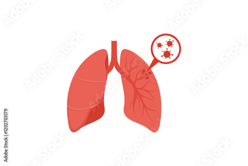 Infected Lungs Showing Viral Infection In Respiratory System. flat style illustration vector
