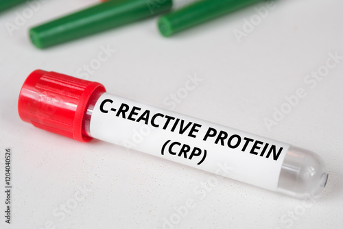 C-reactive protein (CRP)name of blood test photo