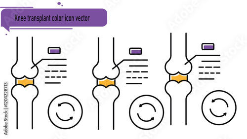 Knee transplant color icon vector