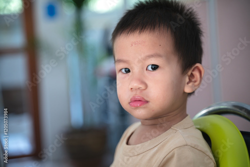 Closeup portrait of a young boy with a scratch on his forehead and saliva on his lips, sitting on a high chair.