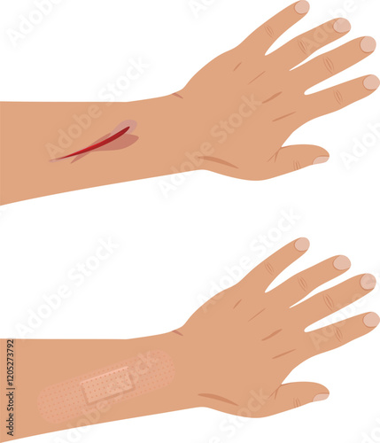 Hand injury patch. vector illustration