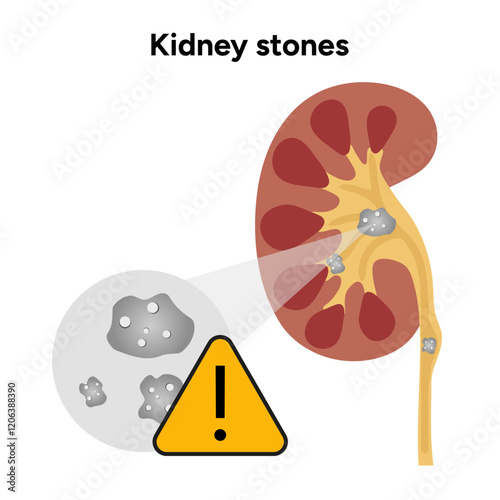 Human urine pain, diagnosis of ureter, kidney stones. Urologist medical disease	