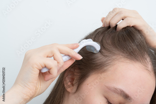 Close up of young woman using microneedling derma roller on head for stimulating new hair growth, copy space for text. Alopecia treatment, scalp stimulation, hair loss and baldness targeted therapy.