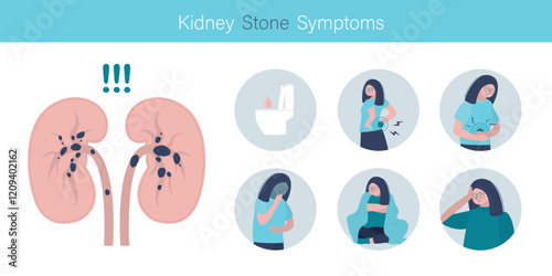 Kidney stones symptoms infographic, medical concept. Diagnosis urinary tract disease. Woman with kidney failure, Chronic infection. illness diagnosis and treatment.