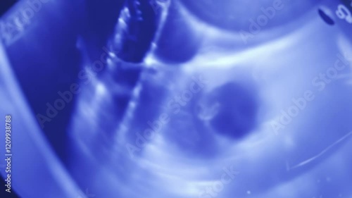Medical ultrasound examination showing prostate gland