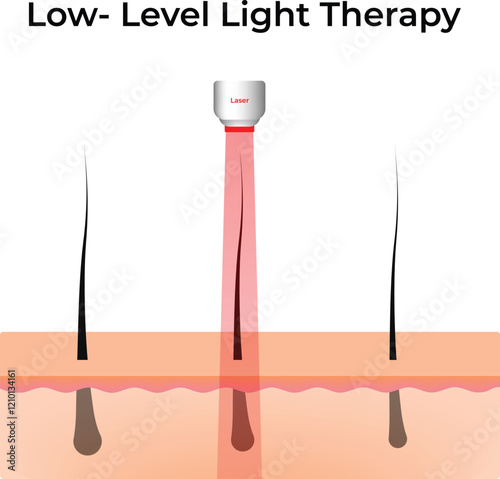 Low-Level Light Therapy for Hair Growth Design Vector Illustration