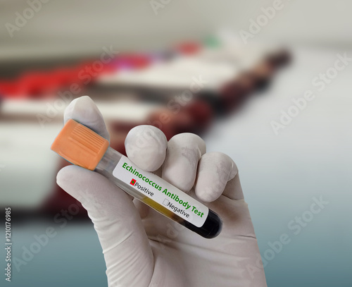 Doctor hold Blood sample for Lymphogranuloma Venereum (LGV) disease diagnosis test. HealthCare and medical concept. photo