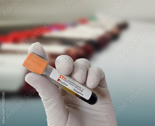 Doctor hold Blood sample for STI (Sexually Transmitted Infection) Test. Positive result test tube. photo