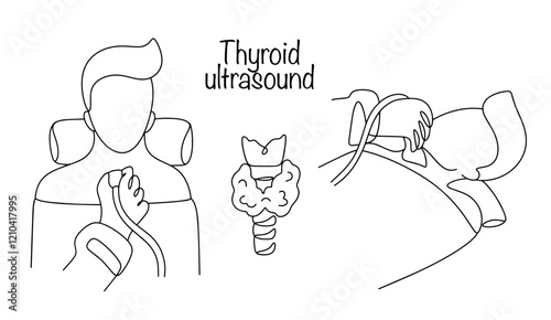 Thyroid ultrasound
