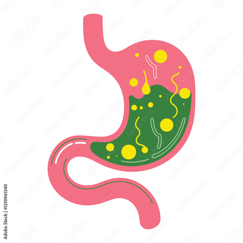 Human stomach vector illustration. Depicts gastritis, acid reflux, heartburn, and stomach pain problems. Concept of illness, discomfort, and unhealthy stomach. Human stomach vector illustration. Depicts gastritis, acid reflux, heartburn, and stomach pain problems. Concept of illness, discomfort, and unhealthy stomach.