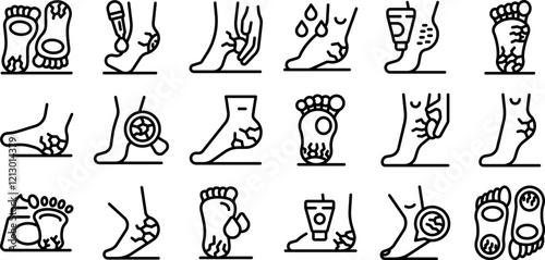 Cracked heels icons set. Cracked heels treatment applying moisturizing cream, using pumice stone and wearing silicone socks