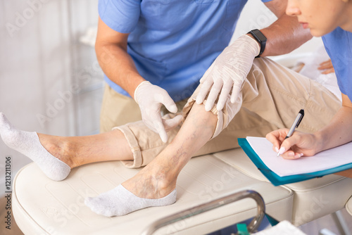 Close-up male doctor exam legs of senior woman against varicose veins, before sclerotherapy treatment. Nurse filling the document. photo