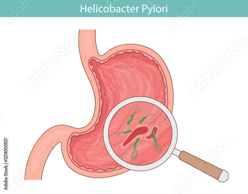 Green bacterium Helicobacter pylori. stomach disease. Vector illustration in cartoon style.