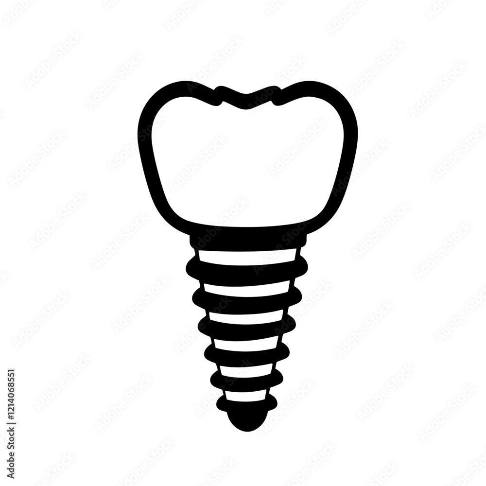 Stylized dental implant design showcasing sleek lines and modern Stylized dental implant design showcasing sleek lines and modern