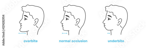 Dental bite variation. Man with malocclusion, bite correction. Vector illustration