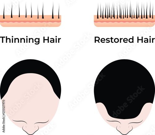 Thinning Hair Restoration Hair Design Vector Illustration