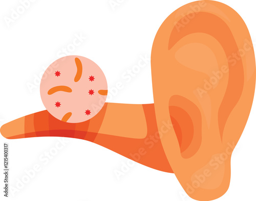 Ear infection caused by bacteria and viruses entering the ear canal, resulting in inflammation and discomfort