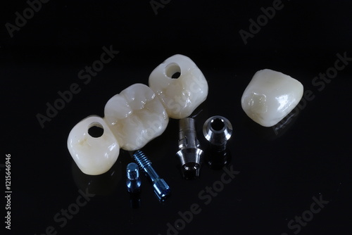 Photography Dental implant surgery and dental implant supported bridge prosthesis
