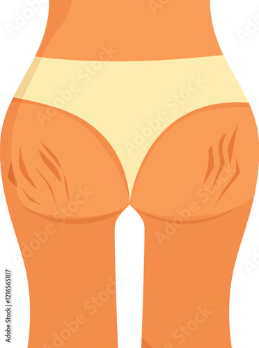 Stretch marks on woman's buttocks and thighs, highlighting cellulite problem, emphasizing body care concept