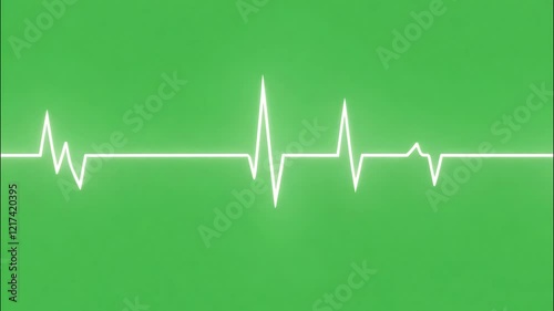 ecg waveform drawing process on green screen background, glowing pulse line forming heartbeat rhythm, perfect for medical visuals
