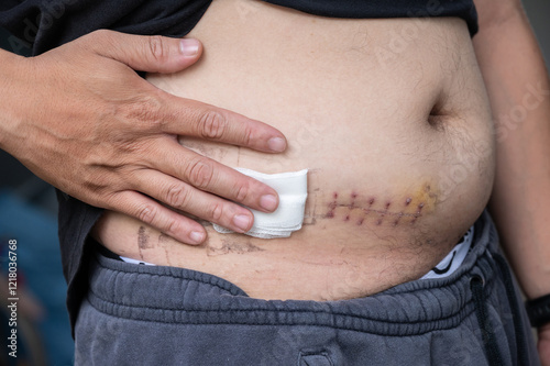 Cropped shot view of patient touching his belly after Appendectomy surgery. After any operation, you'll have some side effects. There is usually some pain with surgery.