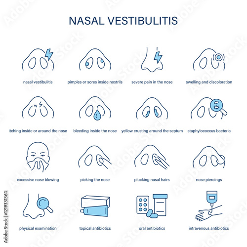Nasal Vestibulitis symptoms, diagnostic and treatment vector icon set. Medical icons.